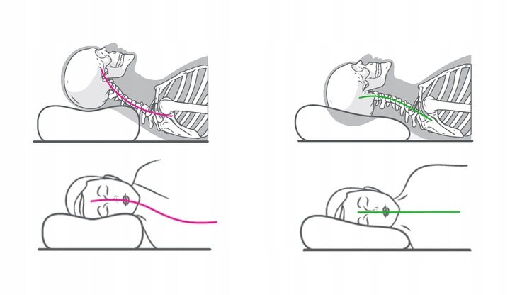 Poduszka ortopedyczna Oromed Oro-Relax - schemat wpływu poduszki na postawę spiącego