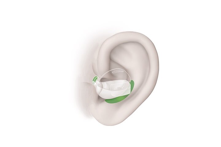 Słuchawki TCL SOCL500TWS purpurowe widok na grafikę ilustrującą słuchawkę włożoną do ucha